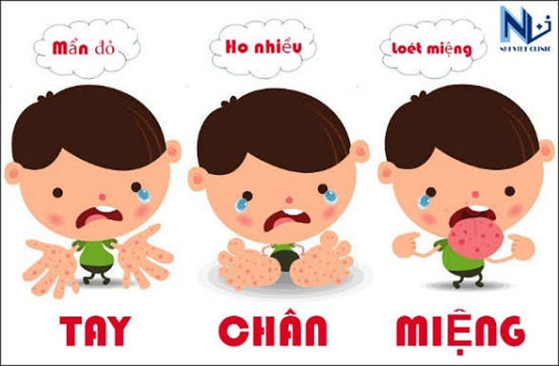 Phòng, chống bệnh tay chân miệng và các bệnh truyền nhiễm khác tại các cơ sở giáo dục